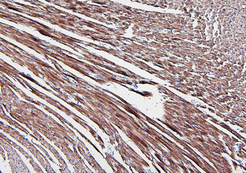 Aldolase/ALDOA Rabbit Polyclonal Antibody