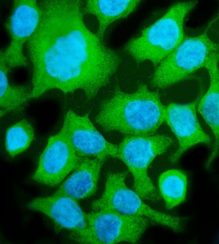 Aldolase/ALDOB Rabbit Polyclonal Antibody
