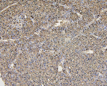 Aldolase/ALDOB Rabbit Polyclonal Antibody