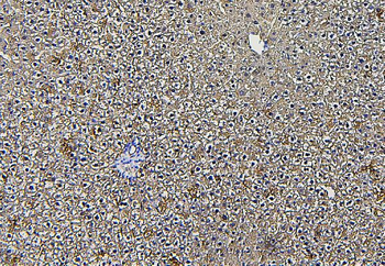 Aldolase/ALDOB Rabbit Polyclonal Antibody
