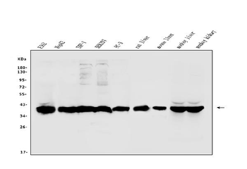 Aldolase/ALDOB Rabbit Polyclonal Antibody