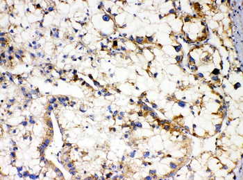 Apolipoprotein L1/APOL1 Rabbit Polyclonal Antibody