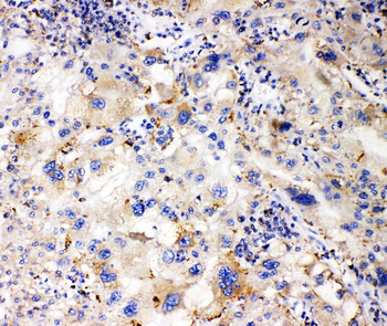 Apolipoprotein L1/APOL1 Rabbit Polyclonal Antibody