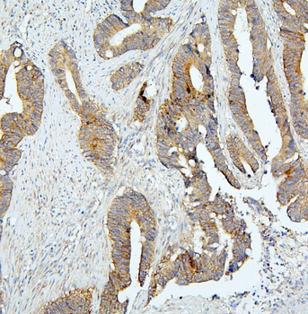 BubR1/BUB1B Antibody