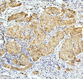 BubR1/BUB1B Antibody