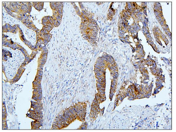 BubR1/BUB1B Antibody
