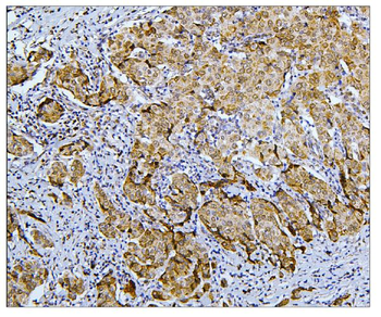 BubR1/BUB1B Antibody
