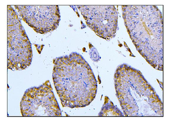 BubR1/BUB1B Antibody
