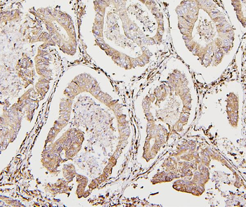 Calreticulin/CALR Antibody