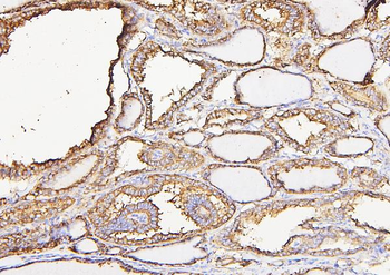 Calreticulin/CALR Antibody