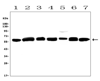 Calreticulin/CALR Antibody