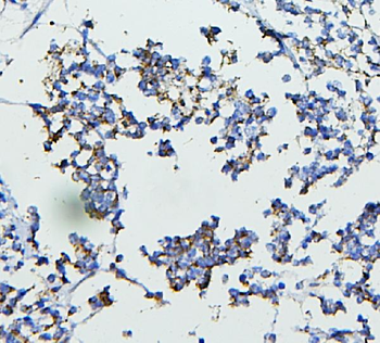 CETP Rabbit Polyclonal Antibody