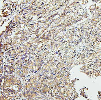 CETP Rabbit Polyclonal Antibody