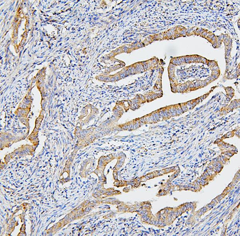 CETP Rabbit Polyclonal Antibody