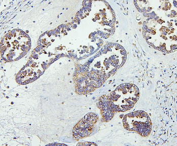 CETP Rabbit Polyclonal Antibody