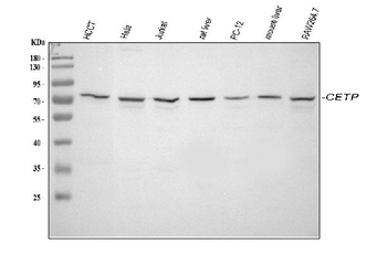 CETP Rabbit Polyclonal Antibody