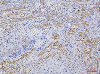 CD35/CR1 Rabbit Polyclonal Antibody