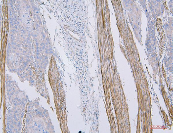 CD35/CR1 Rabbit Polyclonal Antibody
