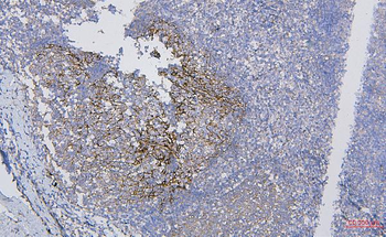 CD35/CR1 Rabbit Polyclonal Antibody