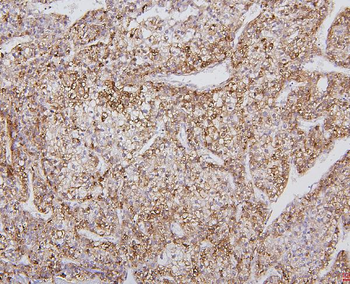 Cytochrome P450 2E1/CYP2E1 Rabbit Polyclonal Antibody