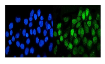 MCK10/NEP/DDR1 Antibody