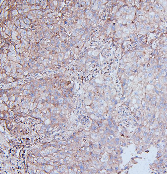 MCK10/NEP/DDR1 Antibody