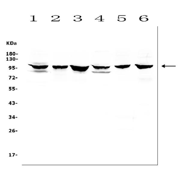 MCK10/NEP/DDR1 Antibody