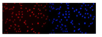 DDX5 Rabbit Polyclonal Antibody