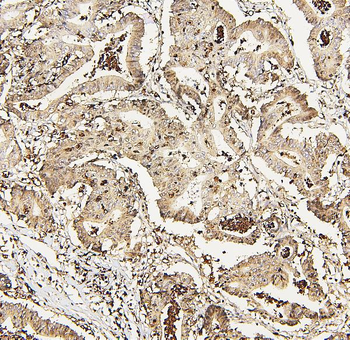 DDX5 Rabbit Polyclonal Antibody