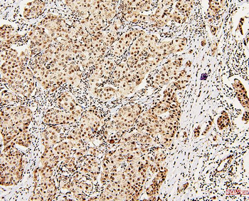 DDX5 Rabbit Polyclonal Antibody