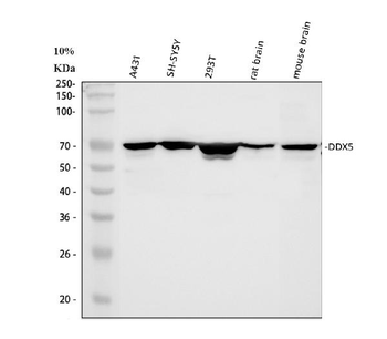 DDX5 Rabbit Polyclonal Antibody