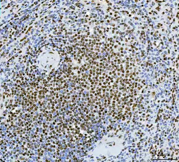 Exonuclease 1/EXO1 Rabbit Polyclonal Antibody