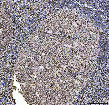 Exonuclease 1/EXO1 Rabbit Polyclonal Antibody