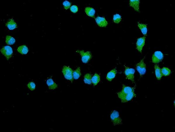 Filamin A/FLNA Rabbit Polyclonal Antibody