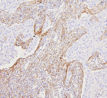 Filamin A/FLNA Rabbit Polyclonal Antibody