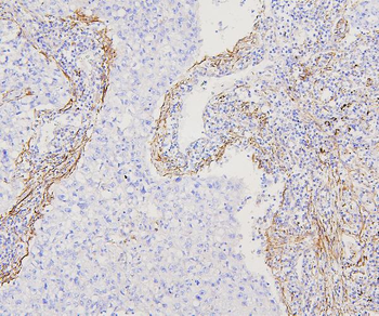 Filamin A/FLNA Rabbit Polyclonal Antibody