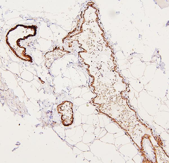 Filamin A/FLNA Rabbit Polyclonal Antibody