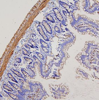 Filamin A/FLNA Rabbit Polyclonal Antibody