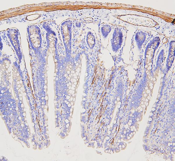 Filamin A/FLNA Rabbit Polyclonal Antibody