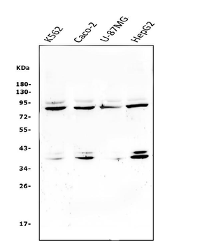 beta glucuronidase/GUSB Rabbit Polyclonal Antibody