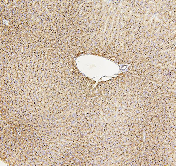 beta glucuronidase/Gusb Rabbit Polyclonal Antibody