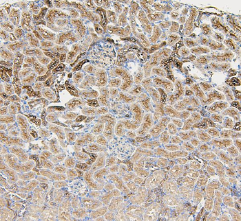 beta glucuronidase/Gusb Rabbit Polyclonal Antibody