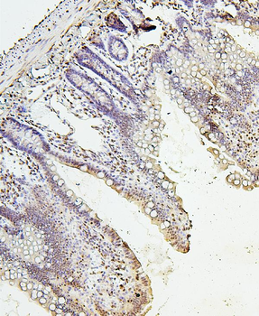 Histone H1.0/H1F0 Antibody
