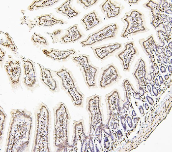 Histone H1.0/H1F0 Antibody