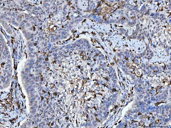 HLA-DR/HLA-DRA Antibody