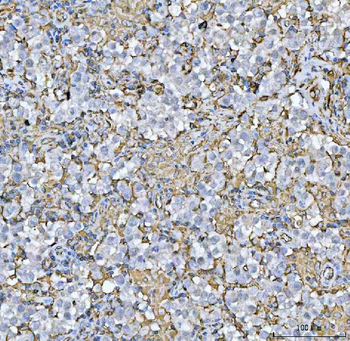HLA-DR/HLA-DRA Antibody