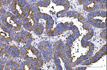 IQGAP1 Rabbit Polyclonal Antibody