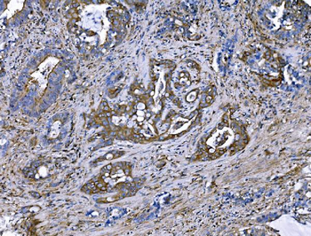 IQGAP1 Rabbit Polyclonal Antibody