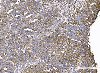 IQGAP1 Rabbit Polyclonal Antibody