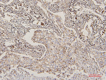 Lipoma-preferred partner LPP Rabbit Polyclonal Antibody